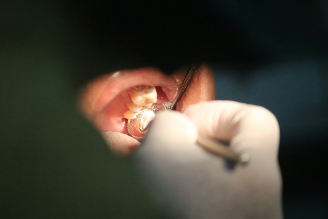 Kırıkhan Kelce Diş Endodonti ve Kanal Tedavisi - Hacı Osman Kelce Diş Kliniği